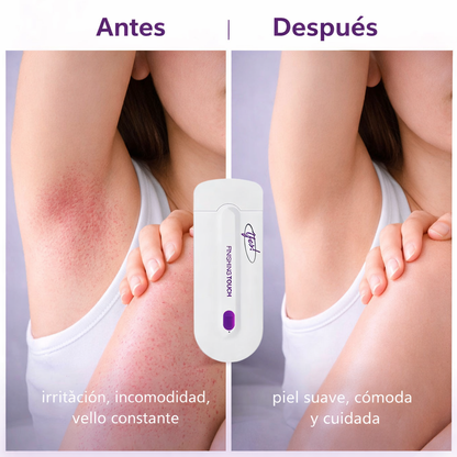 LumiSkin Pro® La forma inteligente de eliminar el vello